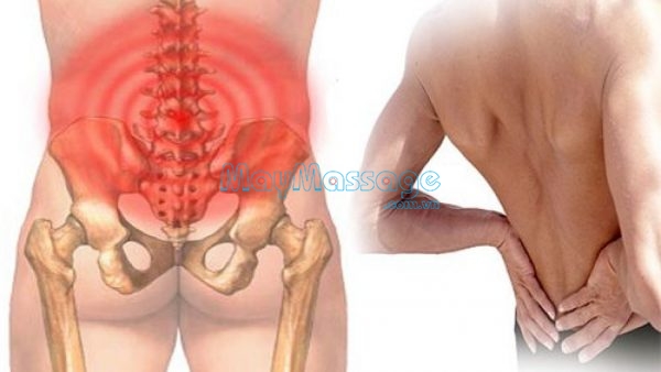 Đau lưng dưới gần mông ở nam giới thường sẽ đau âm ỉ và đau nhói 