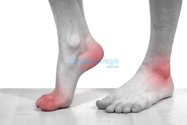 Đau nhức xương khớp chân là dấu hiệu cảnh báo của bệnh lý phức tạp