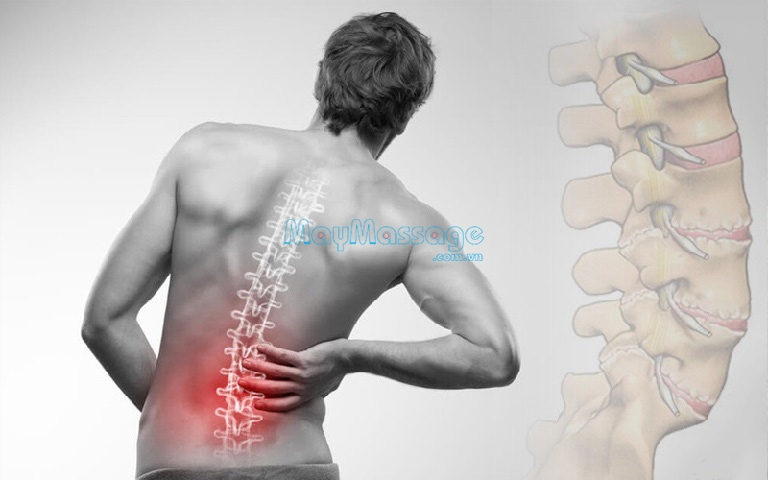 Nên khắc phục chứng đau lưng dưới cột sống để không ảnh hưởng về sau