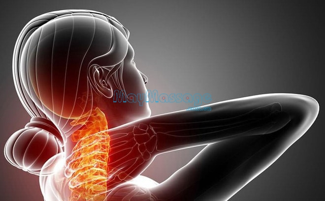 Thần kinh bị chèn ép có thể dẫn đến nguy cơ đau cổ bên trái