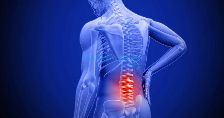 Đau vùng thắt lưng thường sẽ xuất hiện cơn đau âm ỉ và đau nhói 