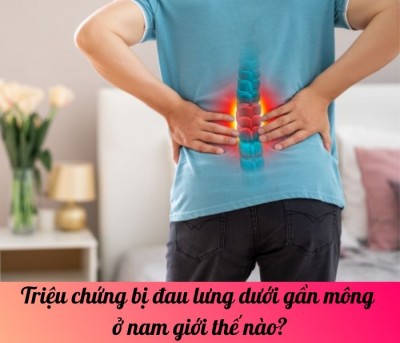 Triệu chứng bị đau lưng dưới gần mông ở nam giới thế nào?