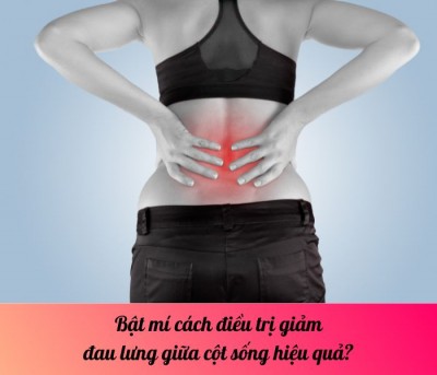 Bật mí cách điều trị giảm đau lưng giữa cột sống hiệu quả?
