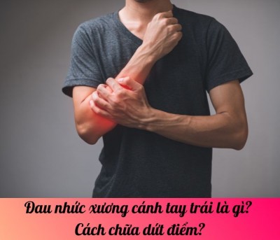 Đau nhức xương cánh tay trái là gì? Cách chữa dứt điểm?