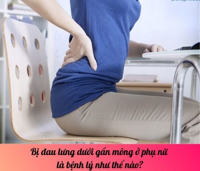 Bị đau lưng dưới gần mông ở phụ nữ là bệnh lý như thế nào?