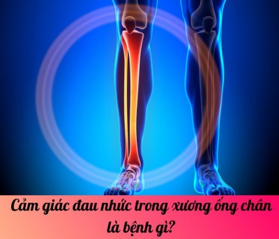 Cảm giác đau nhức trong xương ống chân là bệnh gì?