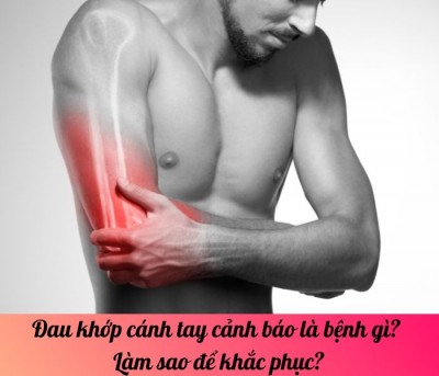 Đau khớp cánh tay cảnh báo là bệnh gì? Làm sao để khắc phục?